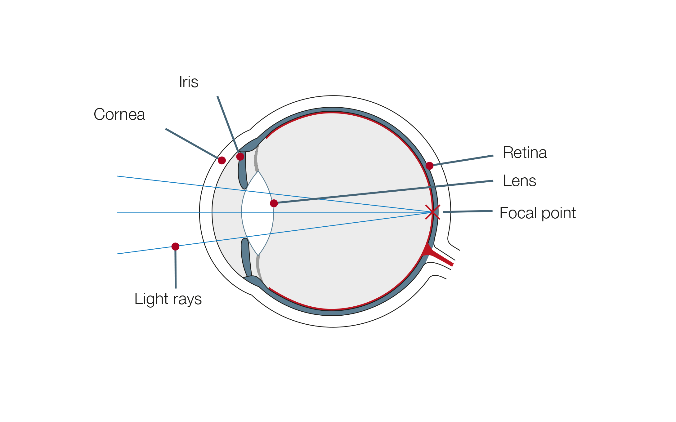 Astigmatism Eye Example