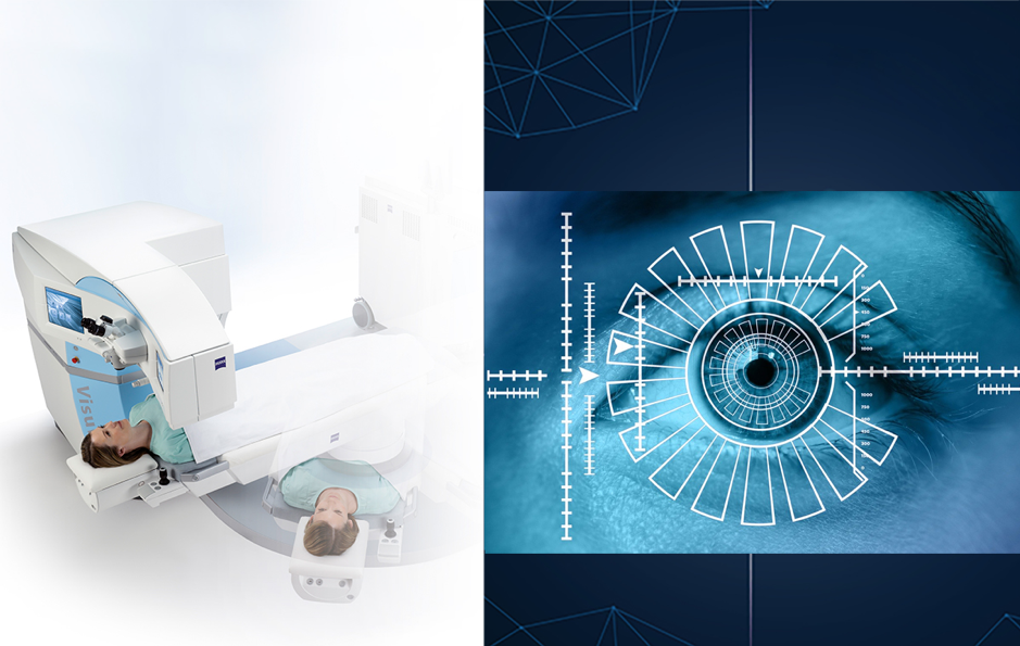 Robotic-eye-surgery